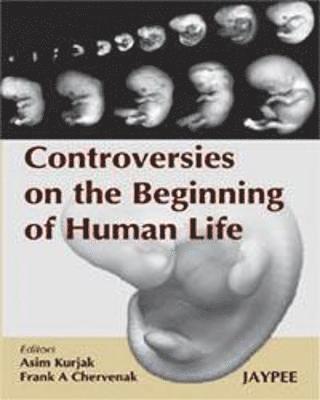Asim Kurjak, Frank A Chervenak - Controversies on the Beginning of Human Life, Inbunden