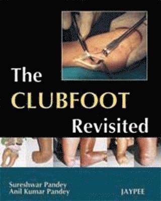 The Club Foot Revisited 1