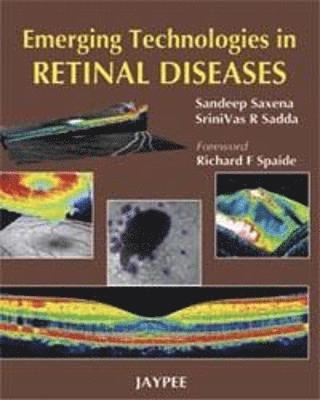 Emerging Technologies in Retinal Disease 1