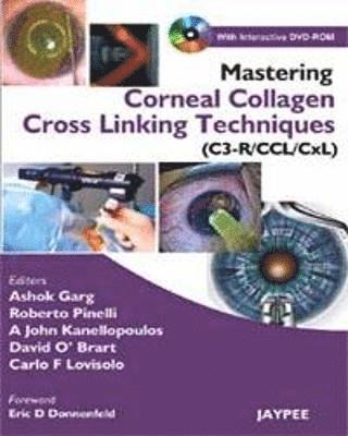Mastering Corneal Collagen Cross Linking Techniques (C3-R/CCL/CXL) 1