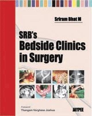 SRB's Bedside Clinics in Surgery 1