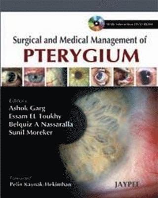 Surgical and Medical Management of Pterygium 1