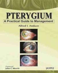 bokomslag Pterygium - A Practical Guide to Management