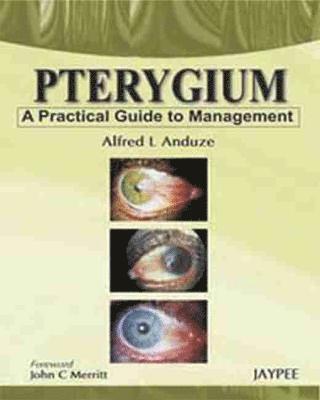 Pterygium - A Practical Guide to Management 1