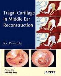 bokomslag Tragal Cartilage in Middle Ear Reconstruction