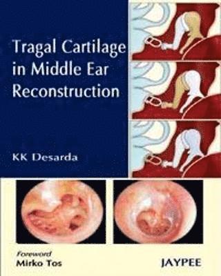 bokomslag Tragal Cartilage in Middle Ear Reconstruction