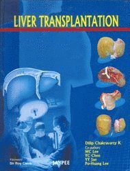 Dilip K Chakravarty - Liver Transplantation, Inbunden