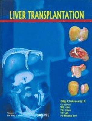 Liver Transplantation 1