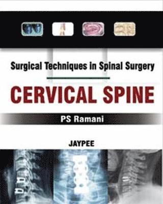 bokomslag Surgical Techniques in Spinal Surgery: Cervical Spine