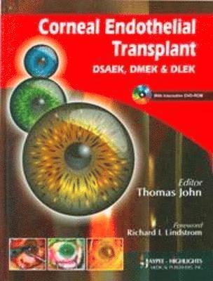bokomslag Corneal Endothelial Transplant DSEAK, DMEK and DLEK