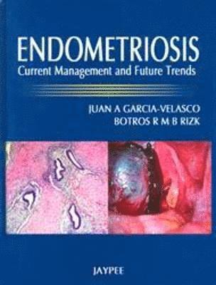 bokomslag Endometriosis