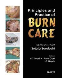 bokomslag Principles and Practice of Burn Care