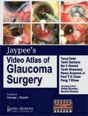 bokomslag Jaypee's Video Atlas of Glaucoma Surgery