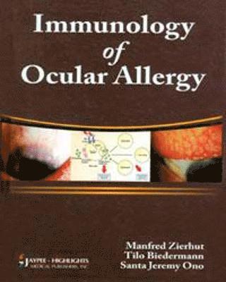 Immunology of Ocular Allergy 1
