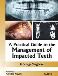 bokomslag A Practical Guide to the Management of Impacted Teeth