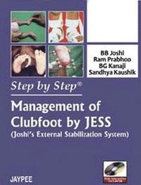 bokomslag Step by Step: Management of Clubfoot by JESS (Joshi's External Stabilization System)