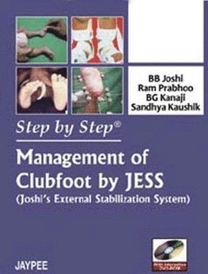 Step by Step: Management of Clubfoot by JESS (Joshi's External Stabilization System) 1