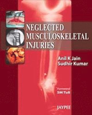 Neglected Musculoskeletal Injuries 1