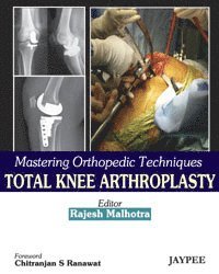 bokomslag Mastering Orthopedic Techniques: Total Knee Arthroplasty