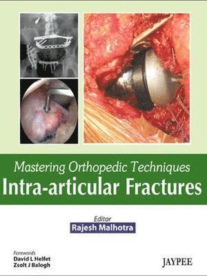 Mastering Orthopedic Techniques: Intra-Articular Fractures 1