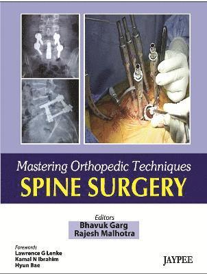 Bhavuk Garg, Rajesh Malhotra - Mastering Orthopaedic Techniques Spine Surgery, Inbunden