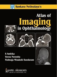 bokomslag Atlas of Imaging in Ophthalmology