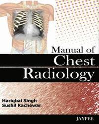 bokomslag Manual of Chest Radiology