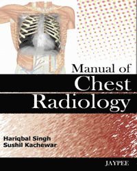 Manual of Chest Radiology