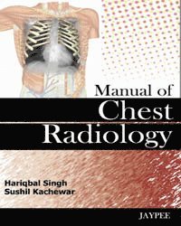 Manual of Chest Radiology 1