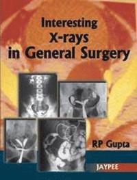 bokomslag Interesting X-Rays in General Surgery