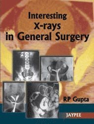 Interesting X-Rays in General Surgery 1