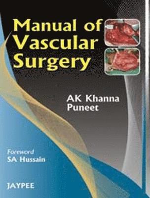 Manual of Vascular Surgery 1