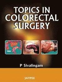 bokomslag Topics in Colorectal Surgery