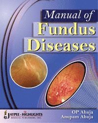 bokomslag Manual of Fundus Diseases