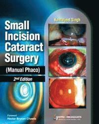 bokomslag Small Incision Cataract Surgery (Manual Phaco)