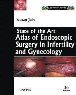 bokomslag State-of-the-Art Atlas of Endoscopic Surgery in Infertility and Gynecology