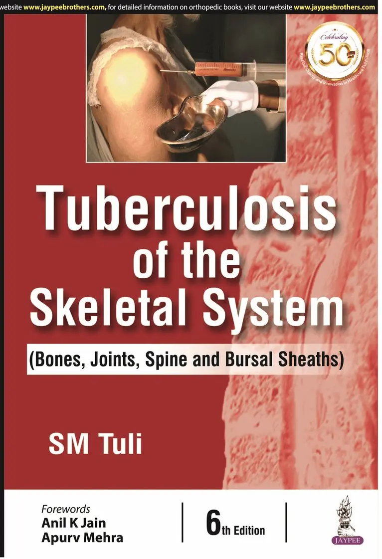 SM Tulsi - Tuberculosis of the Skeletal System, Inbunden. Tillgänglighet: Lägg i varukorg