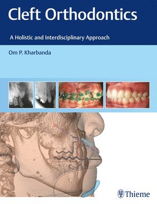 bokomslag Cleft Orthodontics