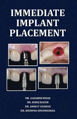 bokomslag Immediate Implant Placement