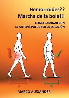 bokomslag ¿Hemorroides? ¡Marcha de la bola!