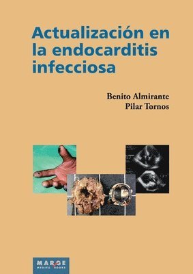 bokomslag Actualizacin en la endocarditis infecciosa