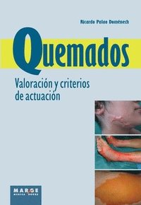bokomslag Quemados. Valoracin y criterios de actuacin