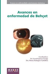 bokomslag Avances en enfermedad de Behçet
