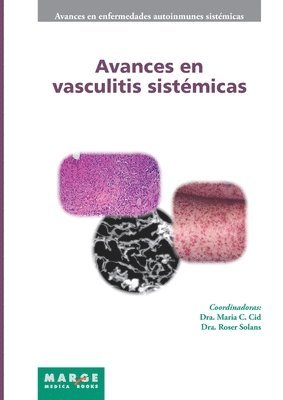 bokomslag Avances en vasculitis sistémicas