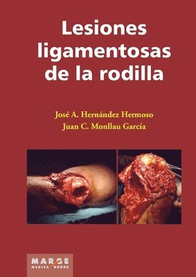 José Antonio Hernández Hermoso, Juan C Monllau García, Juan C. Monllau García, José Antonio Hernández Hermoso - Lesiones ligamentosas de la rodilla, Häftad