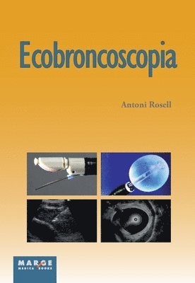 bokomslag Ecobroncoscopia