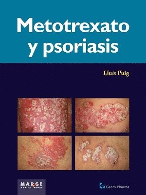 bokomslag Metotrexato y psoriaris