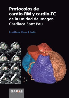 Protocolos de cardio-RM y cardio-TC de la Unidad de Imagen Cardiaca Sant Pau 1