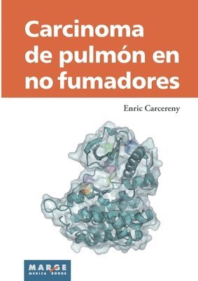 bokomslag Carcinoma de pulmn en no fumadores