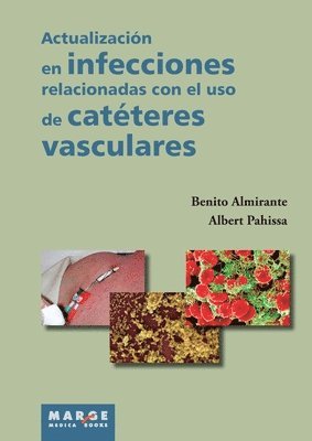 bokomslag Actualización en infecciones relacionadas con el uso de catéteres vasculares